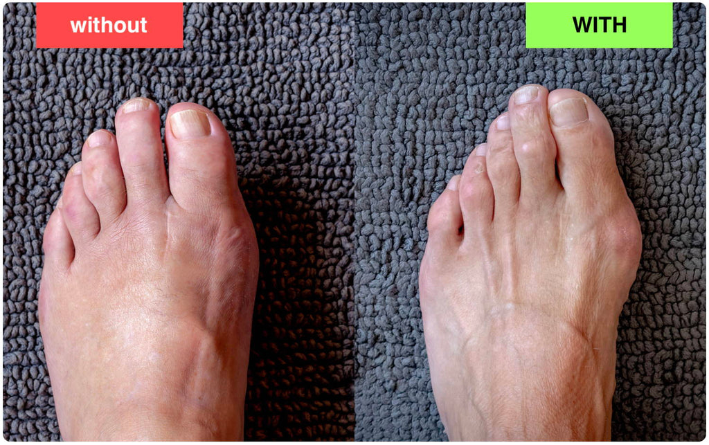 EMSense Foot Massager For Neuropathy Pain Relief